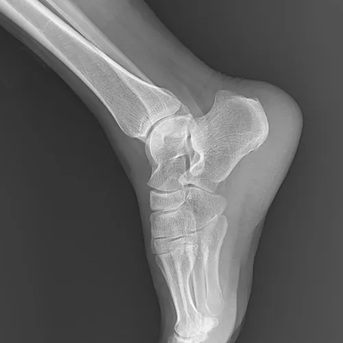 Radiographie des membres 