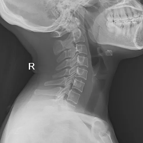 Radiographie de la tête