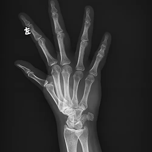 Radiographie des membres 