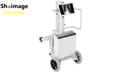 Unité mobile de radiographie numérique SUPREME