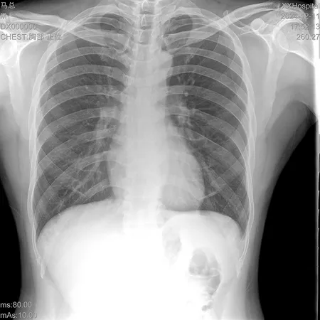 Radiographie thoracique