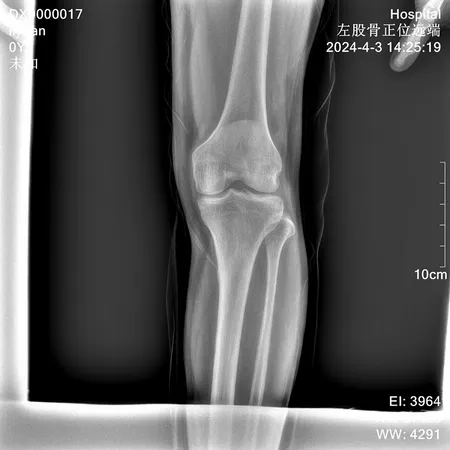 Radiographie thoracique