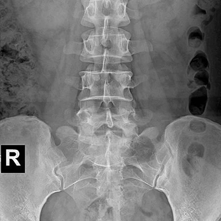 Radiographie abdominale 