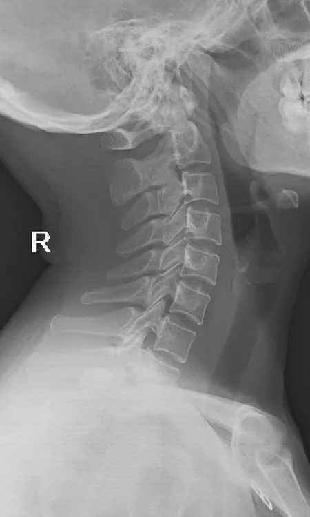 Radiographie de la tête
