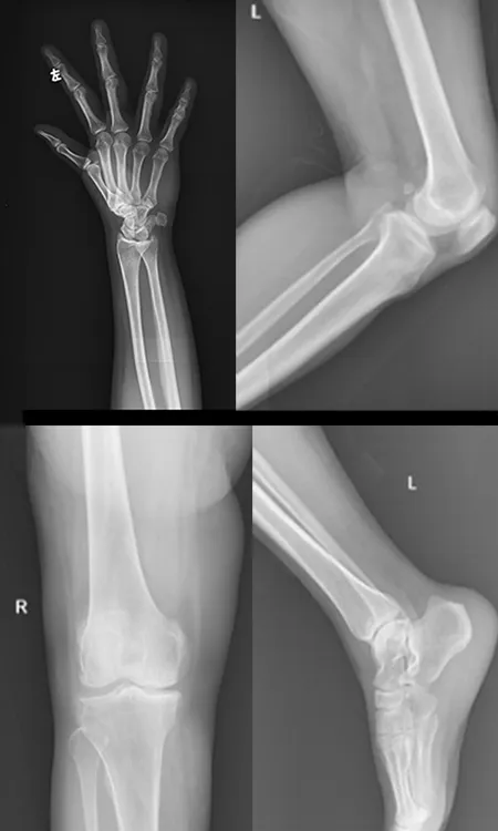 Radiographie des membres 