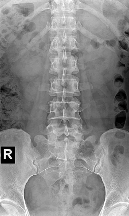 Radiographie abdominale 