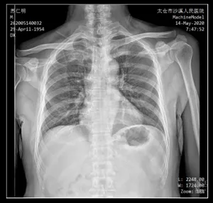 Système de radiographie monté au plafond