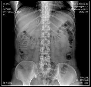 Système de radiographie monté au plafond