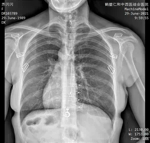 Système de radiographie monté au plafond
