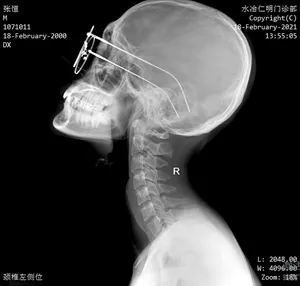 Système de radiographie monté au plafond