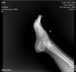Système de radiographie monté au plafond