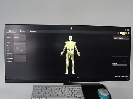 Arceau chirurgical mobile  avec capteur plan