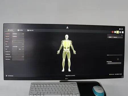 Arceau chirurgical mobile  avec capteur plan