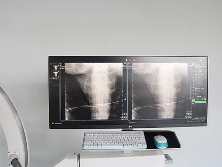 Arceau chirurgical mobile  avec capteur plan