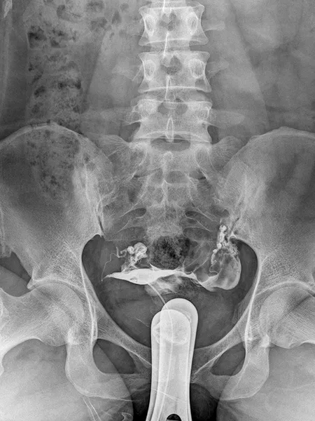Radiographie du système reproducteur